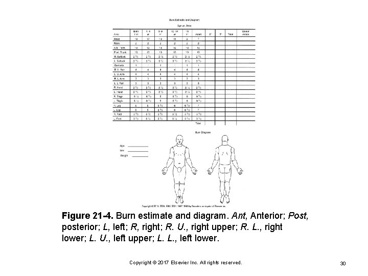 Figure 21 -4. Burn estimate and diagram. Ant, Anterior; Post, posterior; L, left; R,