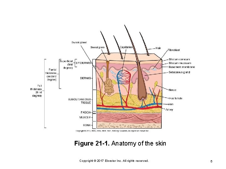 Figure 21 -1. Anatomy of the skin Copyright © 2017 Elsevier Inc. All rights