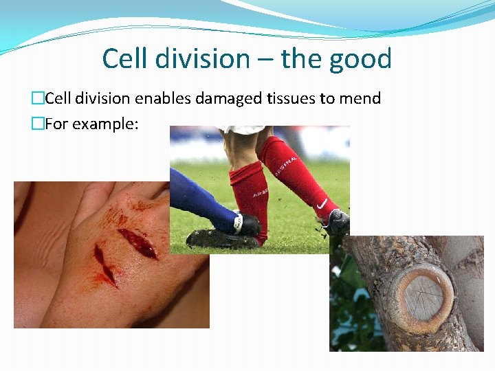 Cell division – the good �Cell division enables damaged tissues to mend �For example: