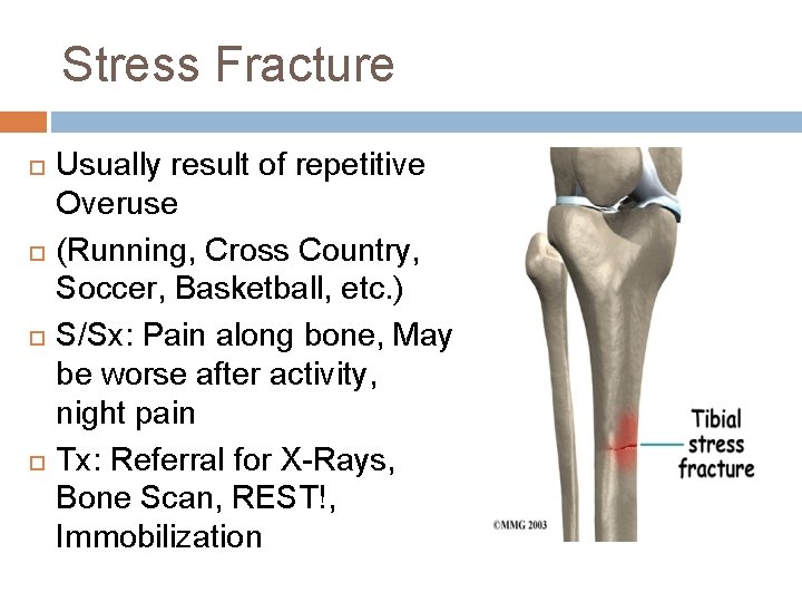 Stress Fracture Usually result of repetitive Overuse (Running, Cross Country, Soccer, Basketball, etc. )