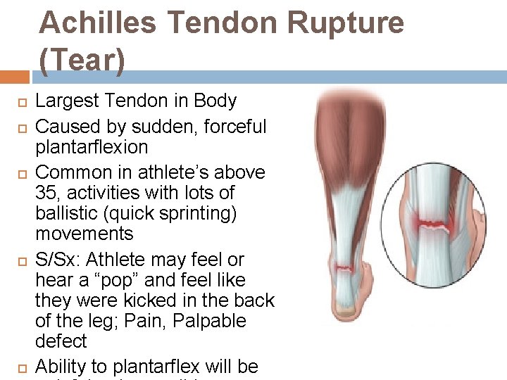 Achilles Tendon Rupture (Tear) Largest Tendon in Body Caused by sudden, forceful plantarflexion Common