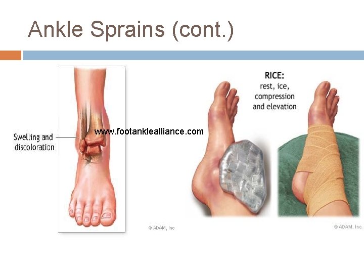 Ankle Sprains (cont. ) www. footanklealliance. com 