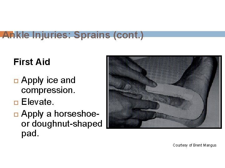 Ankle Injuries: Sprains (cont. ) First Aid Apply ice and compression. Elevate. Apply a