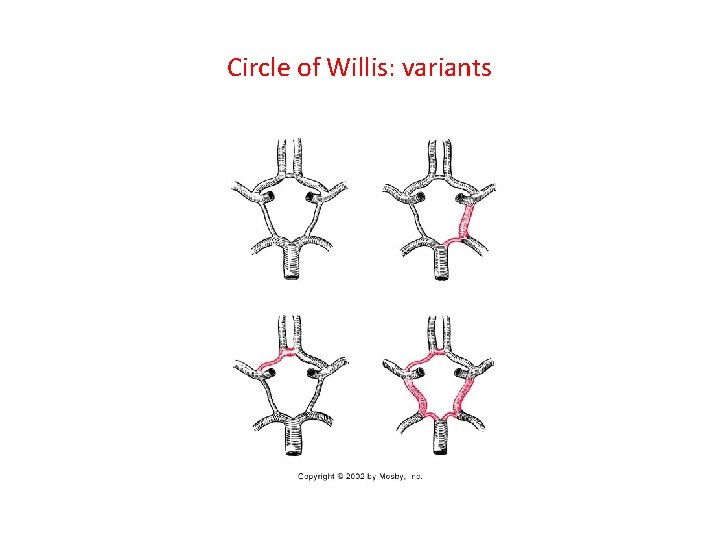 Circle of Willis: variants 