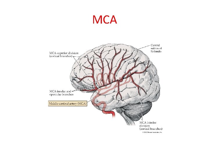 MCA 