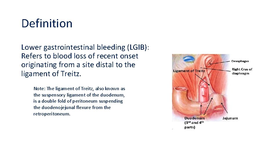 Definition Lower gastrointestinal bleeding (LGIB): Refers to blood loss of recent onset originating from