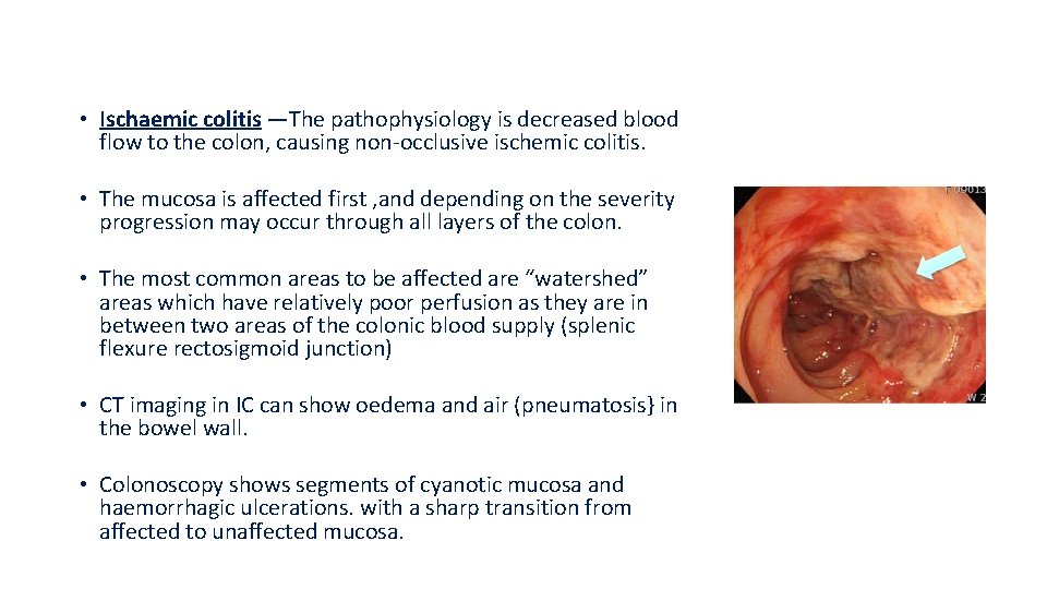  • Ischaemic colitis —The pathophysiology is decreased blood flow to the colon, causing