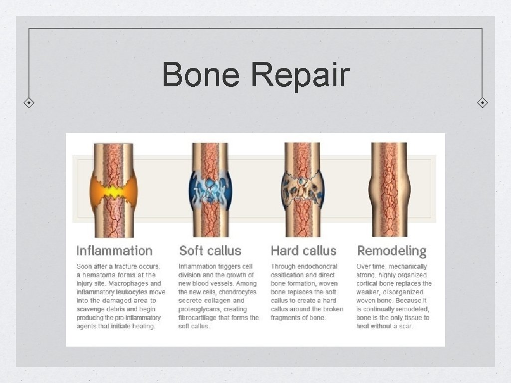 Bone Repair 