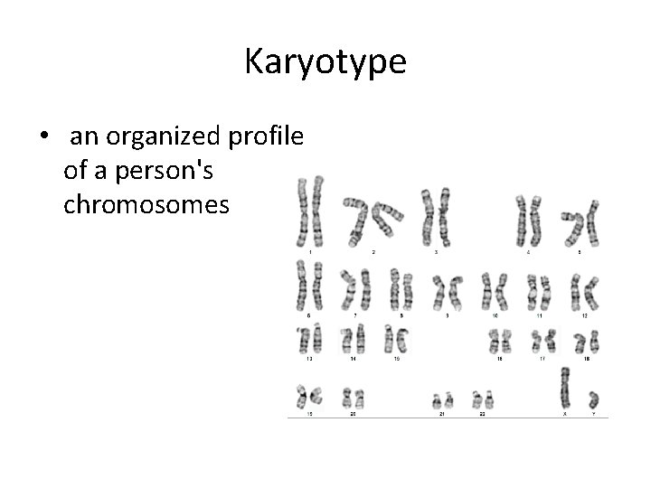 Karyotype • an organized profile of a person's chromosomes 