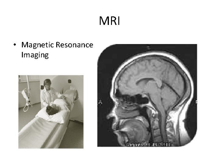 MRI • Magnetic Resonance Imaging 