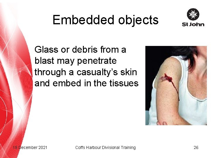 Embedded objects Glass or debris from a blast may penetrate through a casualty’s skin