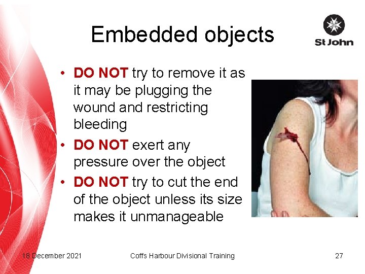Embedded objects • DO NOT try to remove it as it may be plugging
