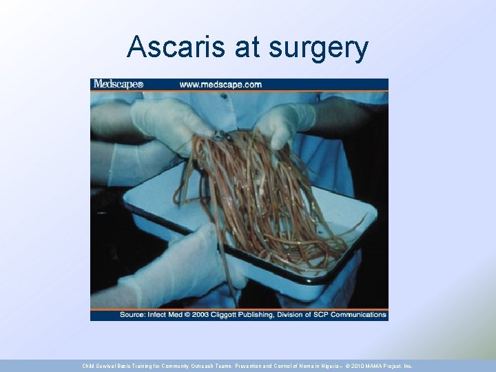 Ascaris at surgery Child Survival Basic Training for Community Outreach Teams- Prevention and Control