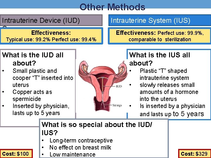 Other Methods Intrauterine Device (IUD) Copper Intrauterine System (IUS) Effectiveness: Perfect use: 99. 9%,