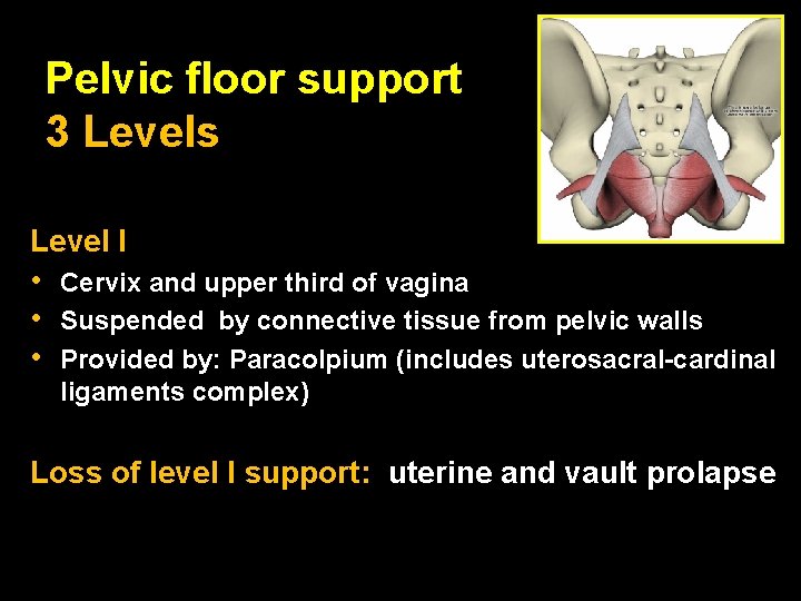 Pelvic floor support 3 Levels Level I • • • Cervix and upper third