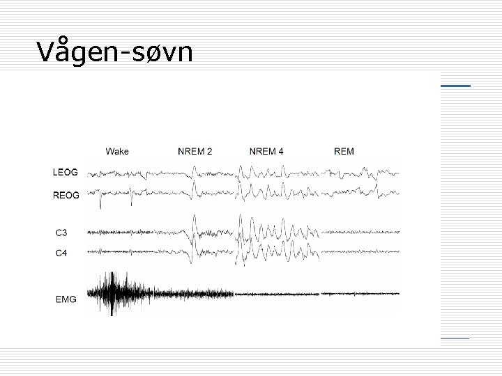 Vågen-søvn 