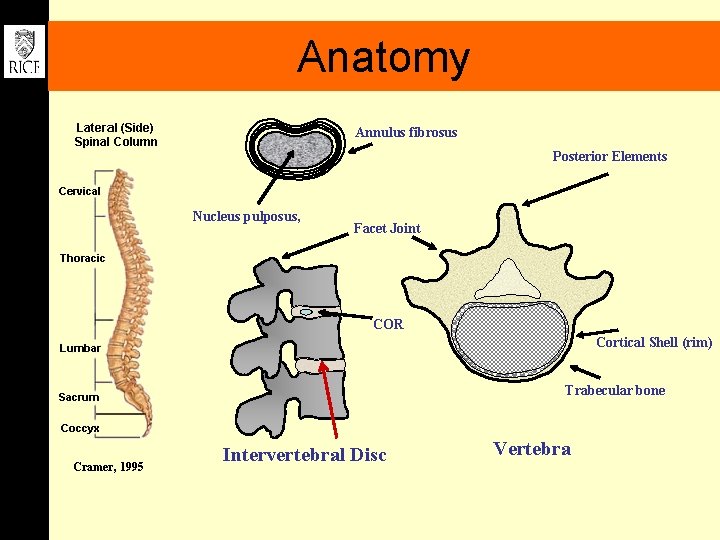 Anatomy Annulus fibrosus Posterior Elements Nucleus pulposus, Facet Joint COR Cortical Shell (rim) Trabecular