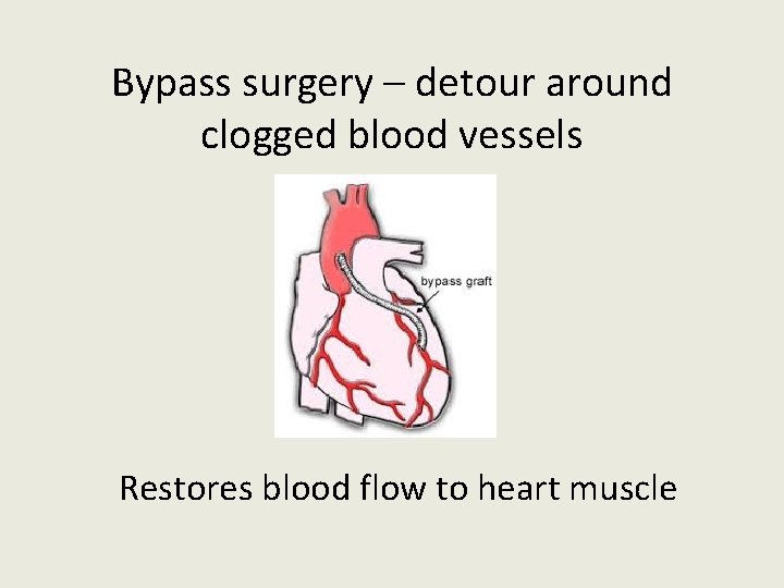 Bypass surgery – detour around clogged blood vessels Restores blood flow to heart muscle