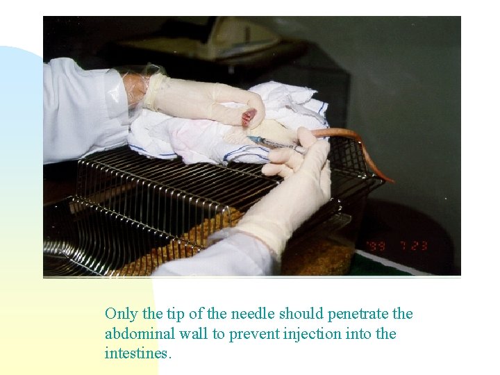 Only the tip of the needle should penetrate the abdominal wall to prevent injection