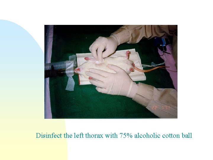 Disinfect the left thorax with 75% alcoholic cotton ball 