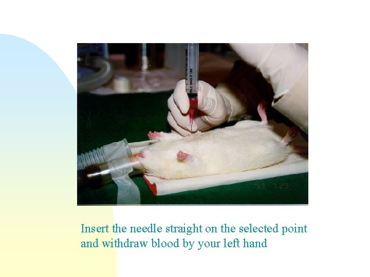 Insert the needle straight on the selected point and withdraw blood by your left