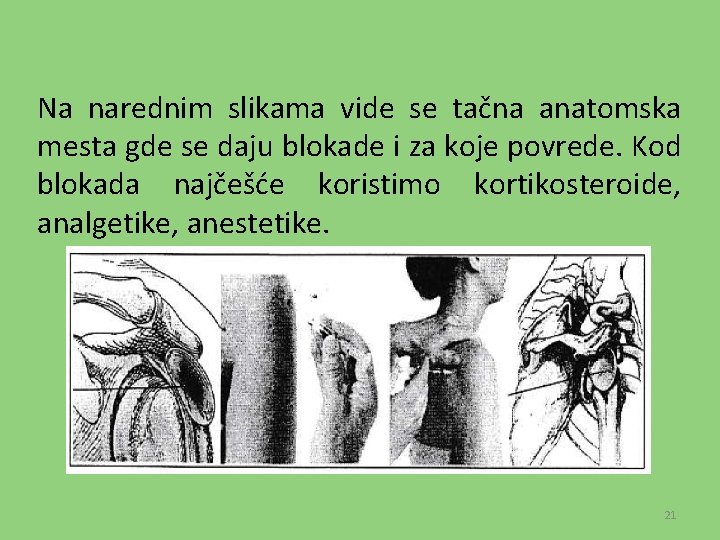 Na narednim slikama vide se tačna anatomska mesta gde se daju blokade i za