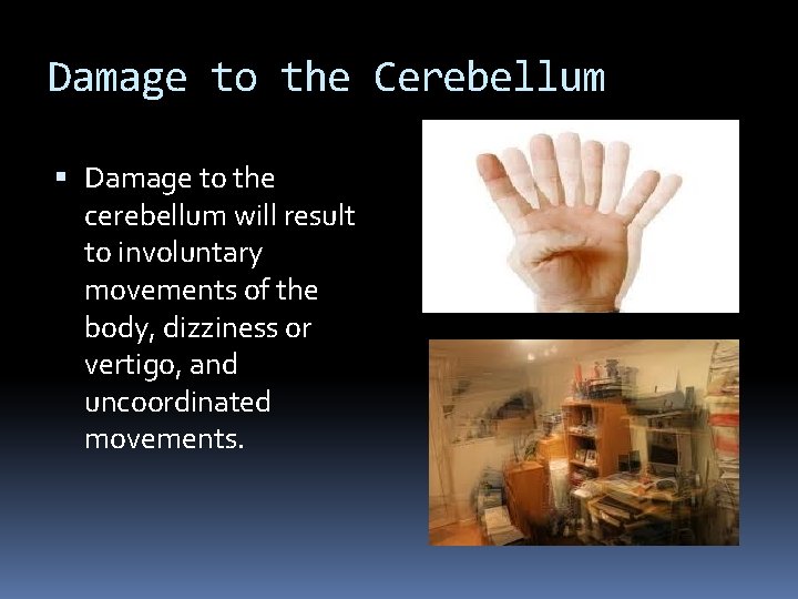 Damage to the Cerebellum Damage to the cerebellum will result to involuntary movements of Damage to the Cerebellum Damage to the cerebellum will result to involuntary movements of