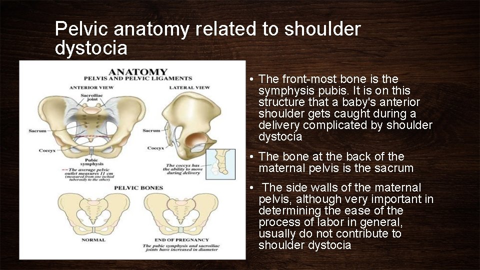 Pelvic anatomy related to shoulder dystocia • The front-most bone is the symphysis pubis.