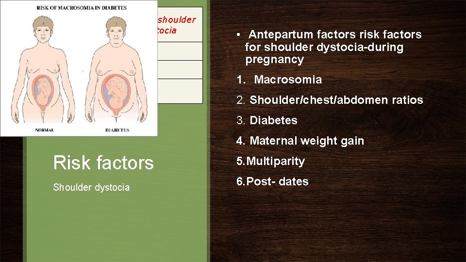 Infant weight in Nondiabetic women Percent shoulder dystocia Less than 4000 g 1. 1%