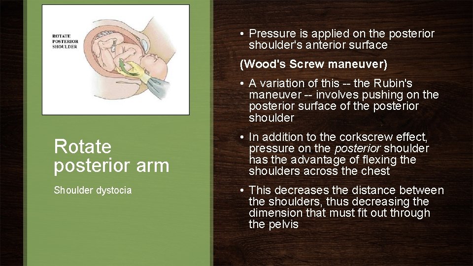 • Pressure is applied on the posterior shoulder's anterior surface (Wood's Screw maneuver)