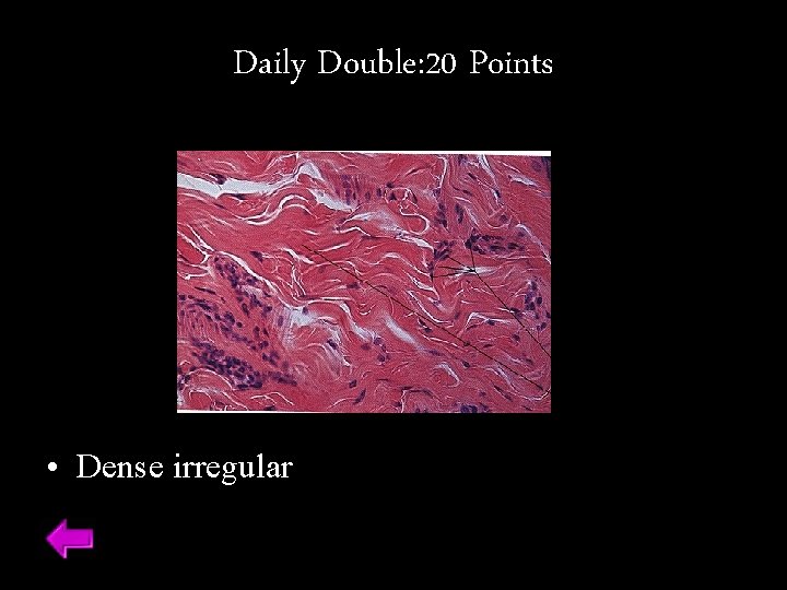 Daily Double: 20 Points • Dense irregular 