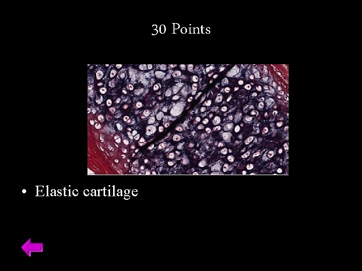 30 Points • Elastic cartilage 