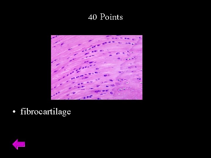 40 Points • fibrocartilage 
