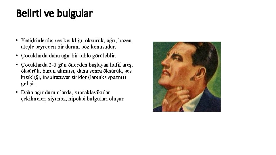 Belirti ve bulgular • Yetişkinlerde; ses kısıklığı, öksürük, ağrı, bazen ateşle seyreden bir durum