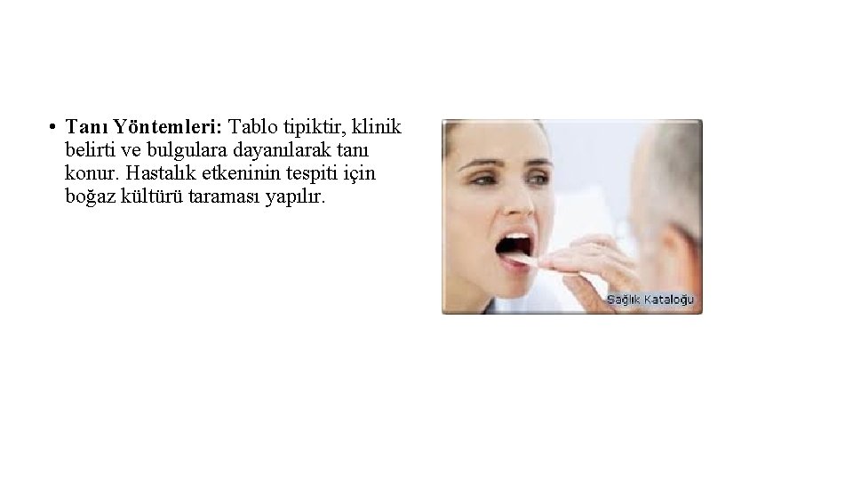  • Tanı Yöntemleri: Tablo tipiktir, klinik belirti ve bulgulara dayanılarak tanı konur. Hastalık