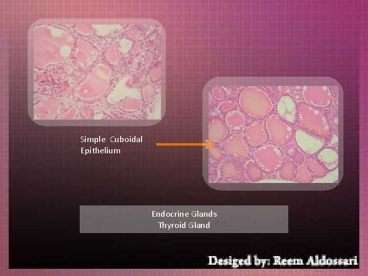 Simple Cuboidal Epithelium Endocrine Glands Thyroid Gland 