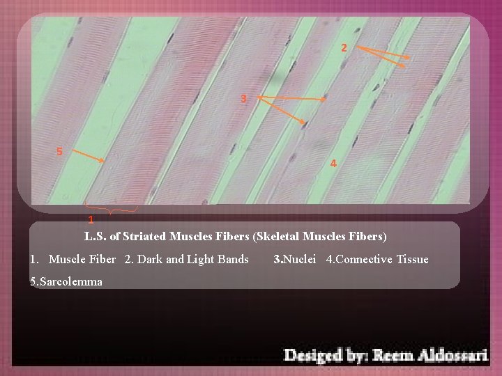 2 3 5 4 1 L. S. of Striated Muscles Fibers (Skeletal Muscles Fibers)