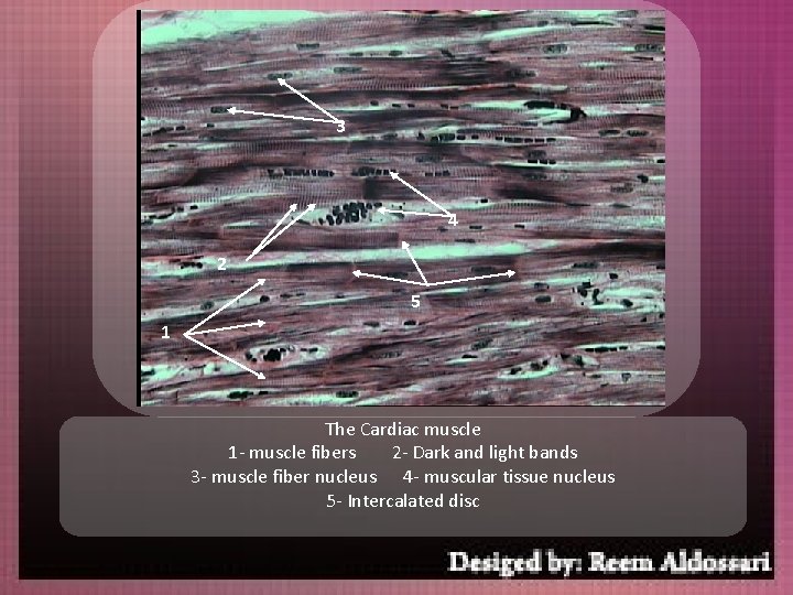 3 4 2 5 1 The Cardiac muscle 1 - muscle fibers 2 -