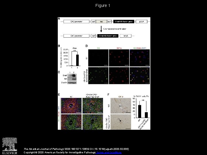 Figure 1 The American Journal of Pathology 2020 1901271 -1283 DOI: (10. 1016/j. ajpath.