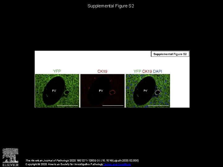 Supplemental Figure S 2 The American Journal of Pathology 2020 1901271 -1283 DOI: (10.