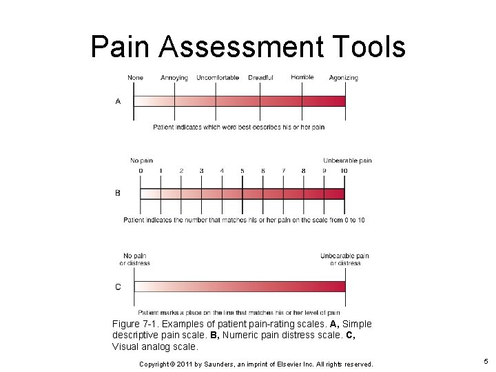 Pain Assessment Tools Figure 7 -1. Examples of patient pain-rating scales. A, Simple descriptive