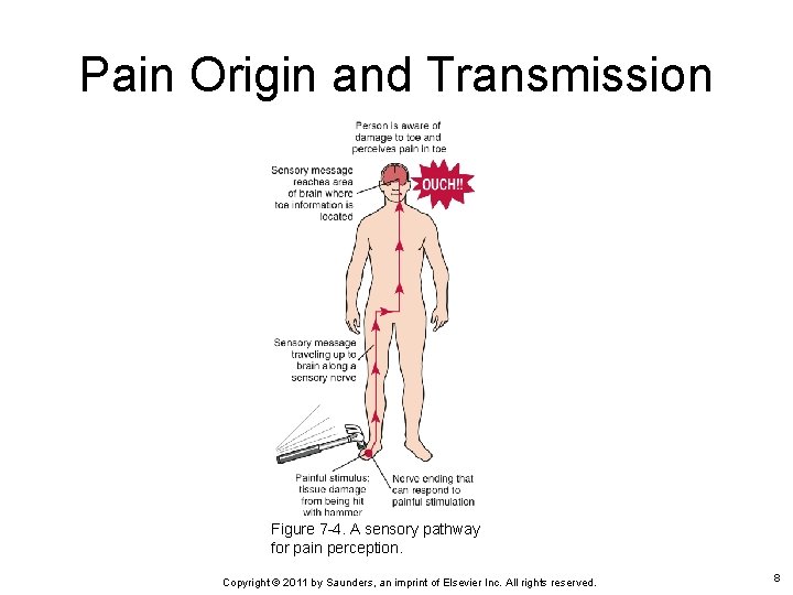 Pain Origin and Transmission Figure 7 -4. A sensory pathway for pain perception. Copyright