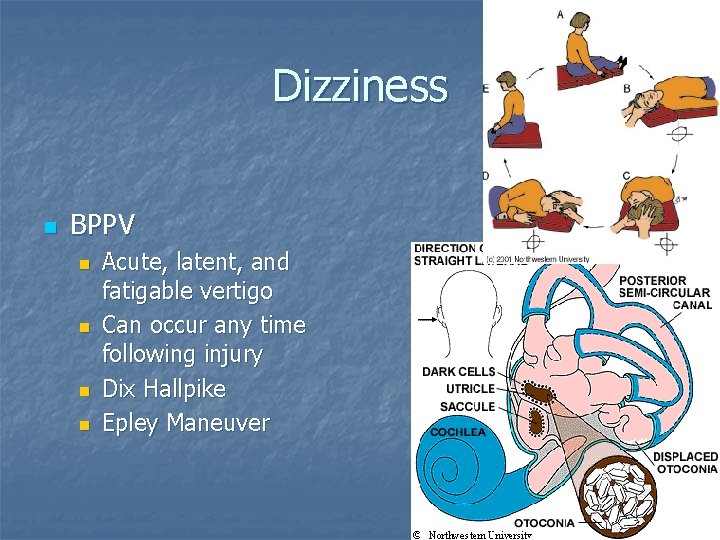 Dizziness n BPPV n n Acute, latent, and fatigable vertigo Can occur any time