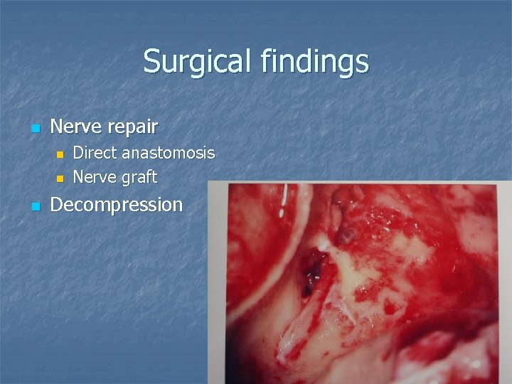 Surgical findings n Nerve repair n n n Direct anastomosis Nerve graft Decompression 