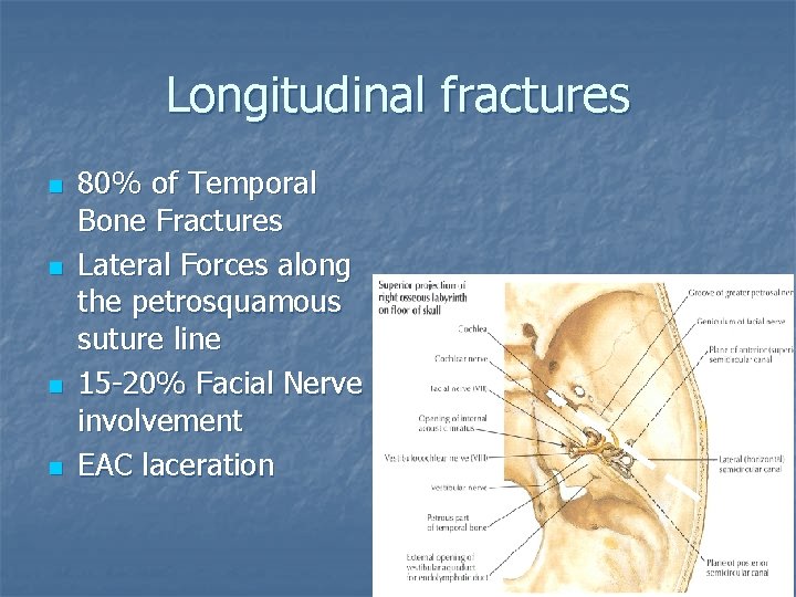 Longitudinal fractures n n 80% of Temporal Bone Fractures Lateral Forces along the petrosquamous