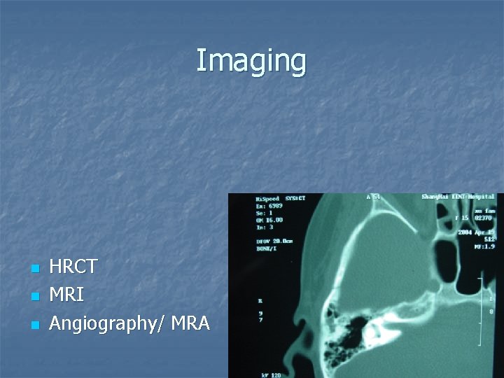 Imaging n n n HRCT MRI Angiography/ MRA 