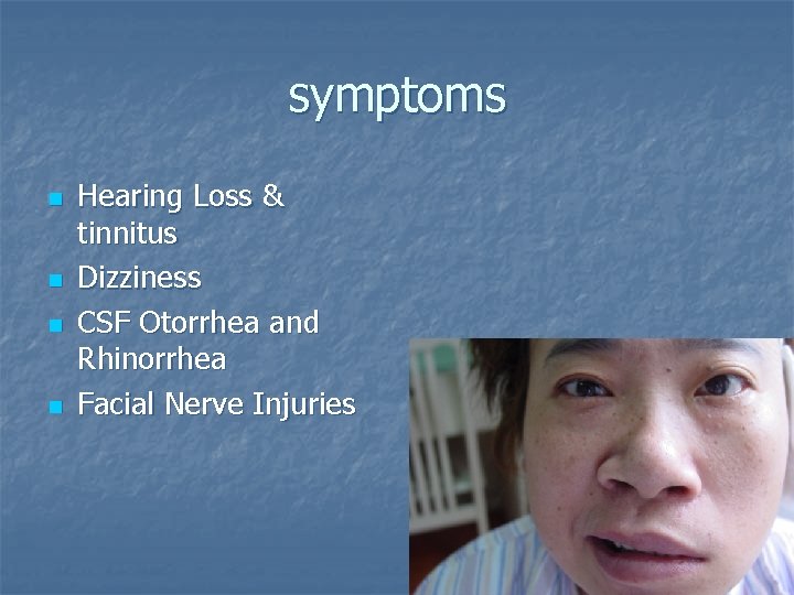 symptoms n n Hearing Loss & tinnitus Dizziness CSF Otorrhea and Rhinorrhea Facial Nerve