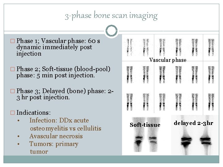 3 -phase bone scan imaging � Phase 1; Vascular phase: 60 s dynamic immediately
