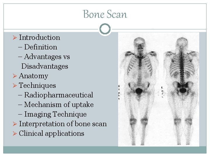 Bone Scan Ø Introduction – Definition – Advantages vs Disadvantages Ø Anatomy Ø Techniques