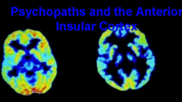 Psychopaths and the Anterior Insular Cortex 